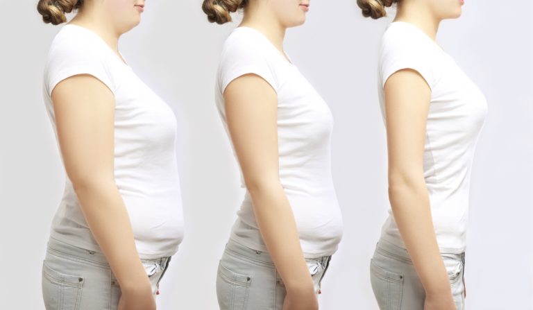 Tirzepatide-Semaglutide-Retatrutide-at-YES-MD-GLP1-s-Weight-Loss-in-Marietta-GA at YES MD Dr Assisted Weight Loss
